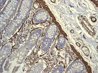 Immunohistochemistry (Formalin/PFA-fixed paraffin-embedded sections) - Anti-alpha smooth muscle Actin antibody [EPR5368] (AB124964)