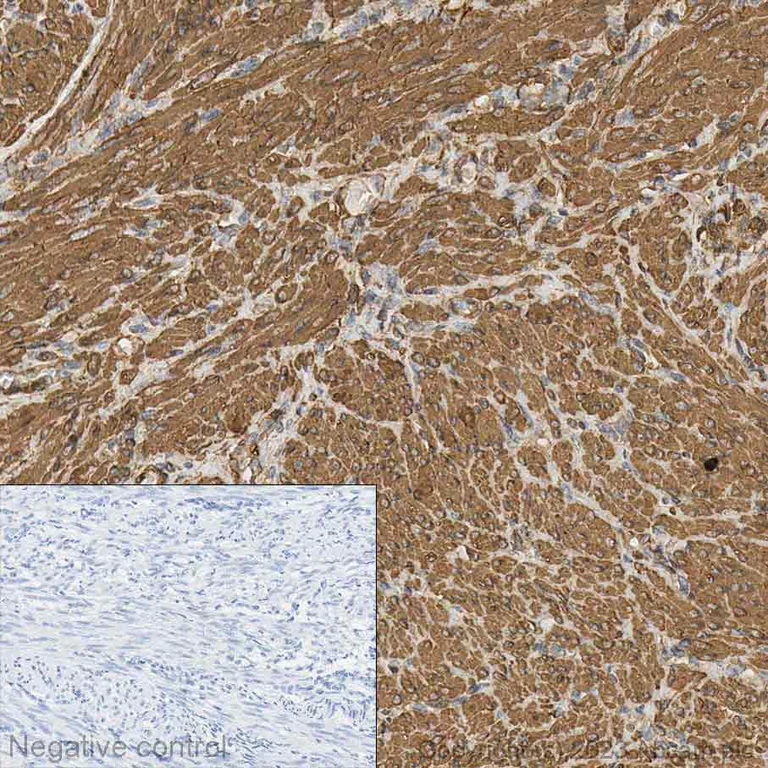 Immunohistochemistry (Formalin/PFA-fixed paraffin-embedded sections) - Anti-alpha smooth muscle Actin antibody [EPR5368] (AB124964)