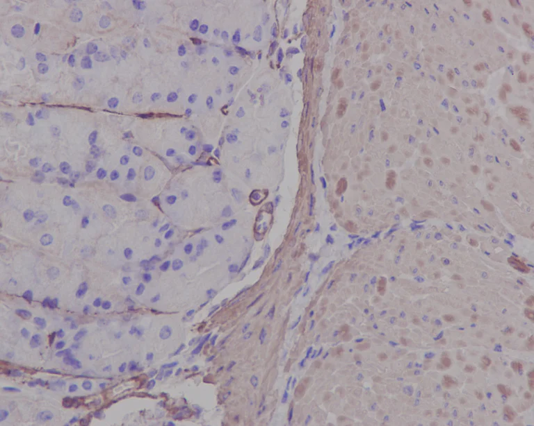 Immunohistochemistry (Formalin/PFA-fixed paraffin-embedded sections) - Anti-alpha smooth muscle Actin antibody [EPR5368] (AB124964)