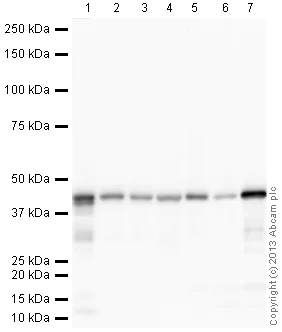 Western blot - Anti-alpha smooth muscle Actin antibody [EPR5368] (AB124964)