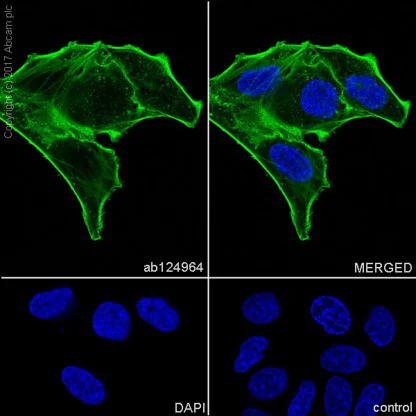 Immunocytochemistry/ Immunofluorescence - Anti-alpha smooth muscle Actin antibody [EPR5368] - BSA and Azide free (AB220795)