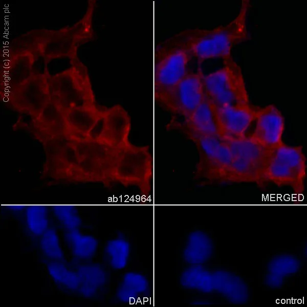 Immunocytochemistry/ Immunofluorescence - Anti-alpha smooth muscle Actin antibody [EPR5368] - BSA and Azide free (AB220795)