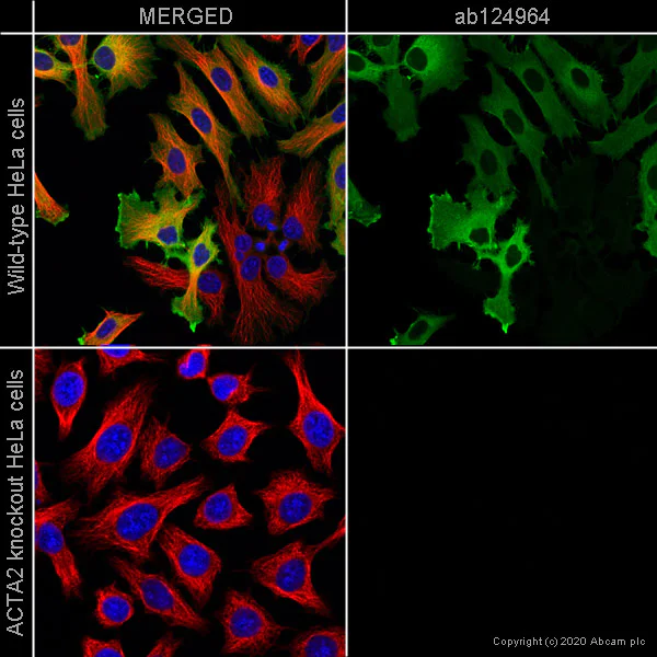 Immunocytochemistry/ Immunofluorescence - Anti-alpha smooth muscle Actin antibody [EPR5368] - BSA and Azide free (AB220795)