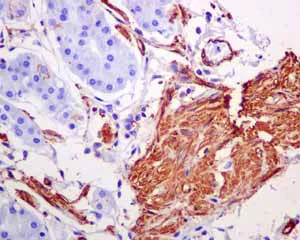 Immunohistochemistry (Formalin/PFA-fixed paraffin-embedded sections) - Anti-alpha smooth muscle Actin antibody [EPR5368] - BSA and Azide free (AB220795)