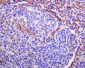 Immunohistochemistry (Formalin/PFA-fixed paraffin-embedded sections) - Anti-alpha smooth muscle Actin antibody [EPR5368] - BSA and Azide free (AB220795)