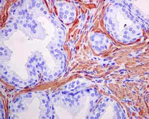 Immunohistochemistry (Formalin/PFA-fixed paraffin-embedded sections) - Anti-alpha smooth muscle Actin antibody [EPR5368] - BSA and Azide free (AB220795)