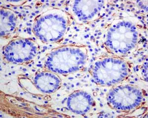 Immunohistochemistry (Formalin/PFA-fixed paraffin-embedded sections) - Anti-alpha smooth muscle Actin antibody [EPR5368] - BSA and Azide free (AB220795)
