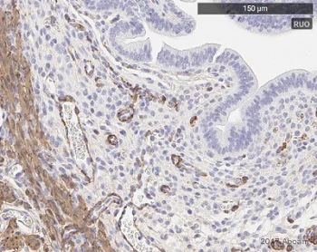 Immunohistochemistry (Formalin/PFA-fixed paraffin-embedded sections) - Anti-alpha smooth muscle Actin antibody [EPR5368] - BSA and Azide free (AB220795)