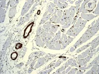 Immunohistochemistry (Formalin/PFA-fixed paraffin-embedded sections) - Anti-alpha smooth muscle Actin antibody [EPR5368] - BSA and Azide free (AB220795)