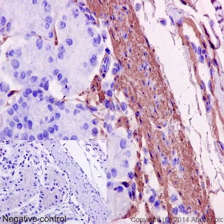 Immunohistochemistry (Formalin/PFA-fixed paraffin-embedded sections) - Anti-alpha smooth muscle Actin antibody [EPR5368] - BSA and Azide free (AB220795)