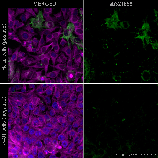 Immunocytochemistry/ Immunofluorescence - Anti-alpha smooth muscle Actin [EPR5368] – Chicken IgY (Chimeric) – BSA and Azide Free (AB322917), expandable thumbnail