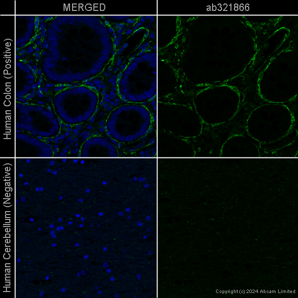 Immunohistochemistry (Formalin/PFA-fixed paraffin-embedded sections) - Anti-alpha smooth muscle Actin [EPR5368] – Chicken IgY (Chimeric) – BSA and Azide Free (AB322917), expandable thumbnail