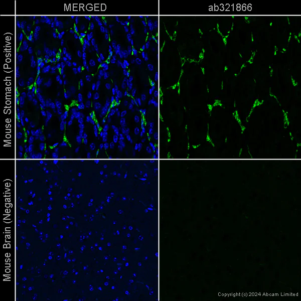 Immunohistochemistry (Formalin/PFA-fixed paraffin-embedded sections) - Anti-alpha smooth muscle Actin antibody [EPR5368] – Chicken IgY (Chimeric) – BSA and Azide Free (AB322917)