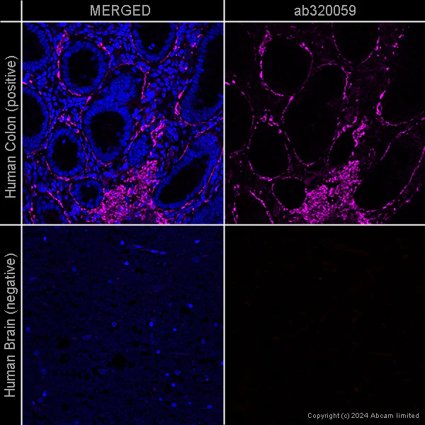 Immunocytochemistry/ Immunofluorescence - Anti-alpha smooth muscle Actin antibody [EPR5368] – Goat IgG (Chimeric) (AB320058)