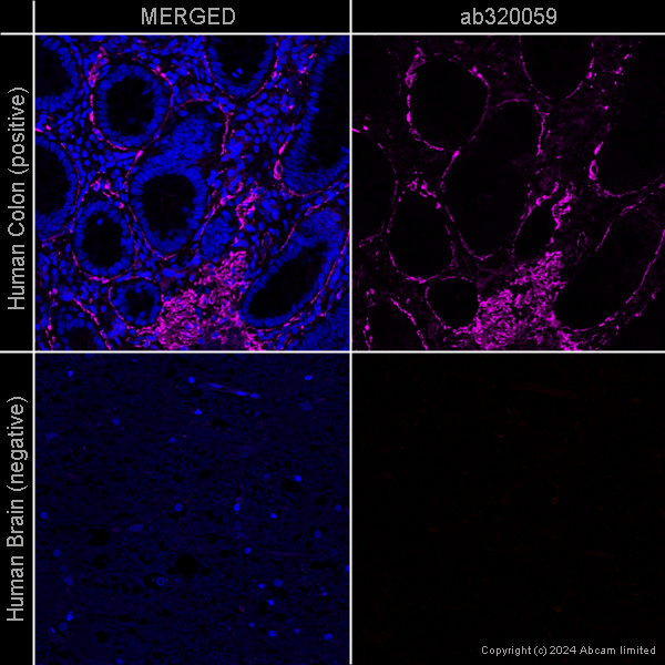 Immunocytochemistry/ Immunofluorescence - Anti-alpha smooth muscle Actin antibody [EPR5368] – Goat IgG (Chimeric) – BSA and Azide Free (AB320059), expandable thumbnail