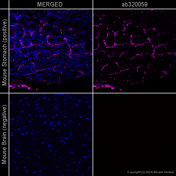 Immunohistochemistry (Formalin/PFA-fixed paraffin-embedded sections) - Anti-alpha smooth muscle Actin antibody [EPR5368] – Goat IgG (Chimeric) – BSA and Azide Free (AB320059), expandable thumbnail