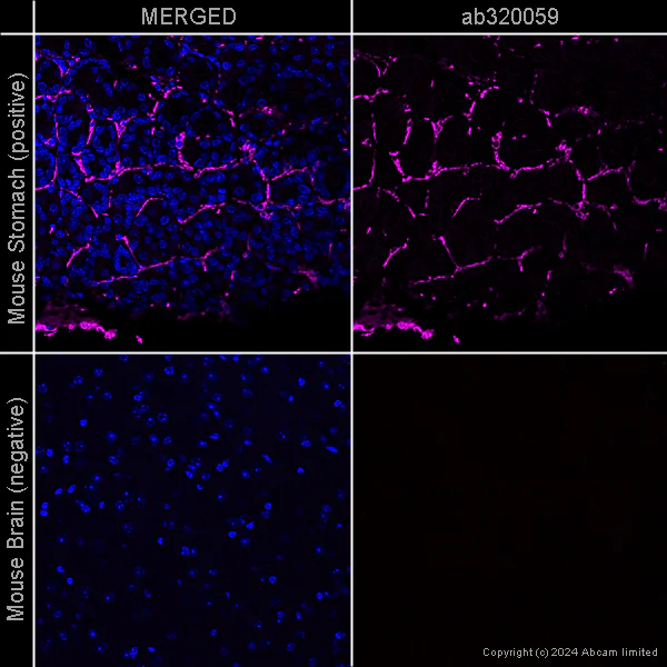 Immunohistochemistry (Formalin/PFA-fixed paraffin-embedded sections) - Anti-alpha smooth muscle Actin antibody [EPR5368] – Goat IgG (Chimeric) – BSA and Azide Free (AB320059)