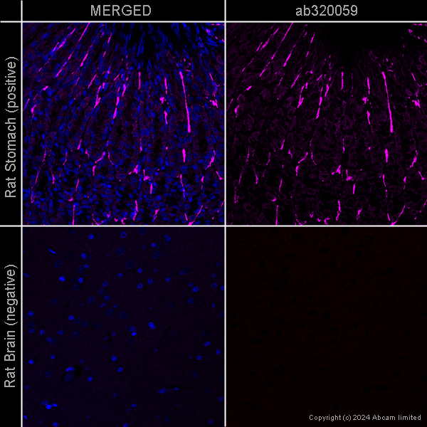 Immunohistochemistry (Formalin/PFA-fixed paraffin-embedded sections) - Anti-alpha smooth muscle Actin antibody [EPR5368] – Goat IgG (Chimeric) – BSA and Azide Free (AB320059), expandable thumbnail