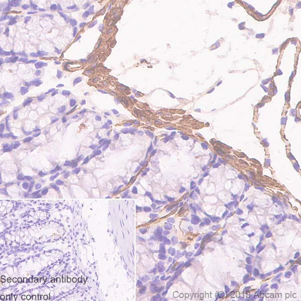 Immunohistochemistry (Formalin/PFA-fixed paraffin-embedded sections) - Anti-alpha smooth muscle Actin antibody [SP171] (AB150301)