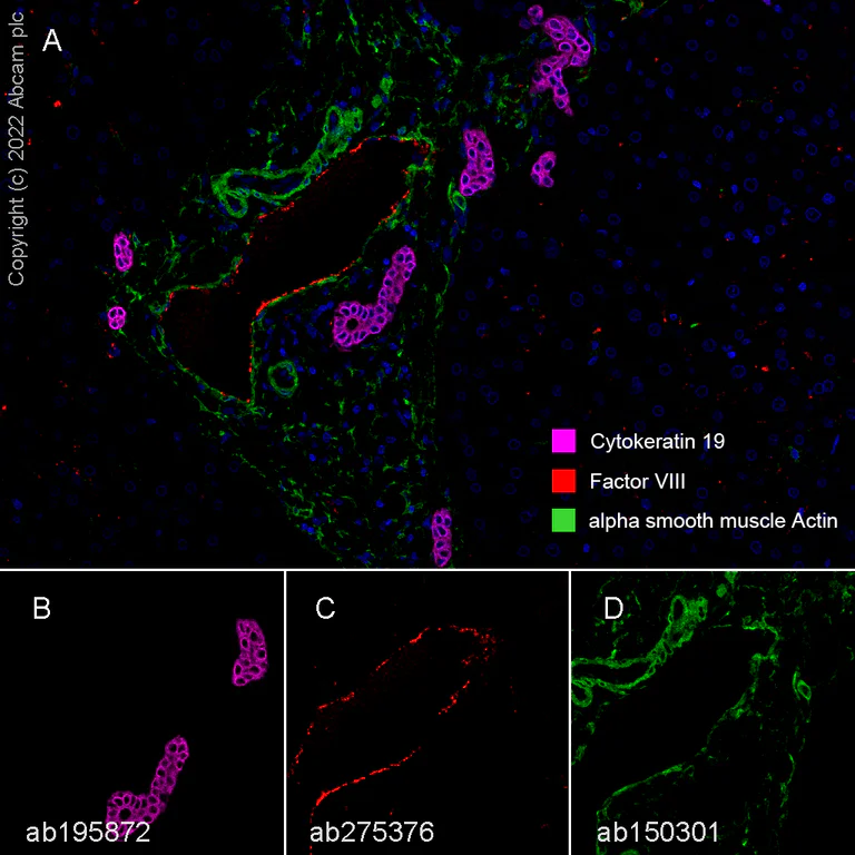 Anti-alpha smooth muscle Actin antibody [SP171] (ab150301