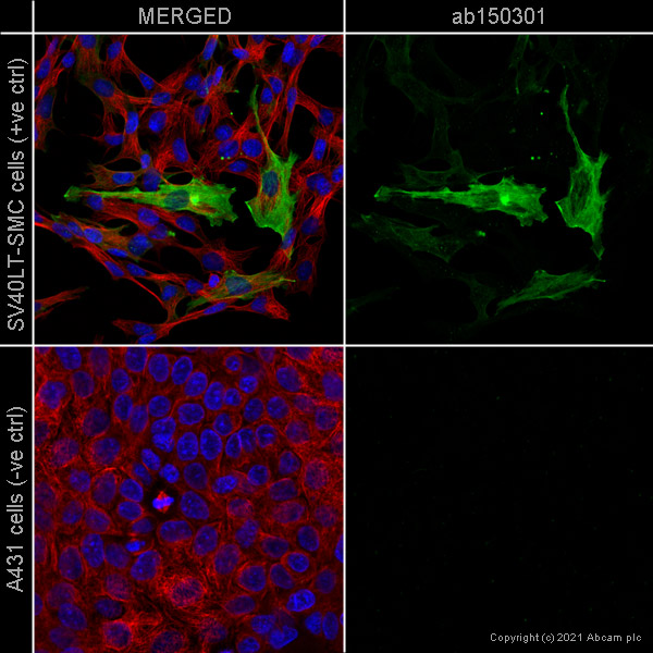 Immunocytochemistry/ Immunofluorescence - Anti-alpha smooth muscle Actin antibody [SP171] - BSA and Azide free (AB242395), expandable thumbnail
