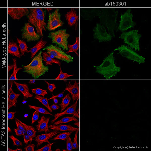 Immunocytochemistry/ Immunofluorescence - Anti-alpha smooth muscle Actin antibody [SP171] - BSA and Azide free (AB242395)