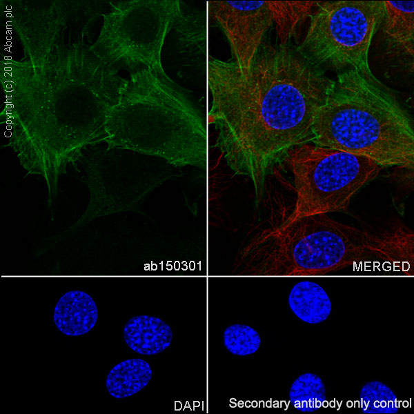 Immunocytochemistry/ Immunofluorescence - Anti-alpha smooth muscle Actin antibody [SP171] - BSA and Azide free (ab242395), expandable thumbnail