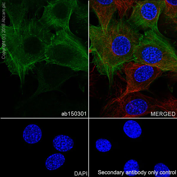Immunocytochemistry/ Immunofluorescence - Anti-alpha smooth muscle Actin antibody [SP171] - BSA and Azide free (AB242395)