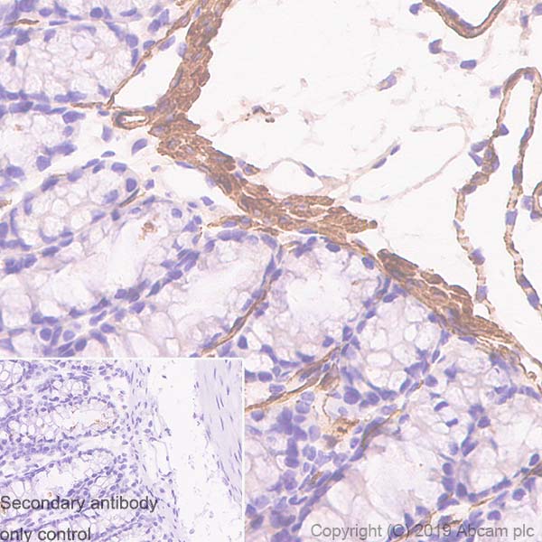 Immunohistochemistry (Formalin/PFA-fixed paraffin-embedded sections) - Anti-alpha smooth muscle Actin antibody [SP171] - BSA and Azide free (AB242395), expandable thumbnail