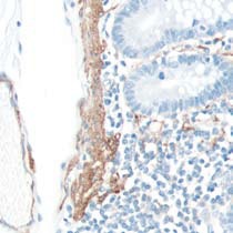 Immunohistochemistry (Formalin/PFA-fixed paraffin-embedded sections) - Anti-alpha smooth muscle Actin antibody [SP171] - BSA and Azide free (ab242395), expandable thumbnail