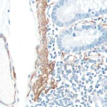 Immunohistochemistry (Formalin/PFA-fixed paraffin-embedded sections) - Anti-alpha smooth muscle Actin antibody [SP171] - BSA and Azide free (AB242395)