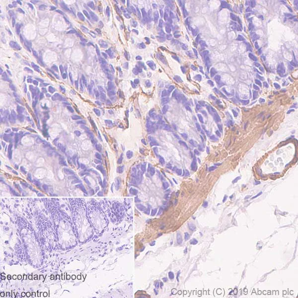 Immunohistochemistry (Formalin/PFA-fixed paraffin-embedded sections) - Anti-alpha smooth muscle Actin antibody [SP171] - BSA and Azide free (AB242395)