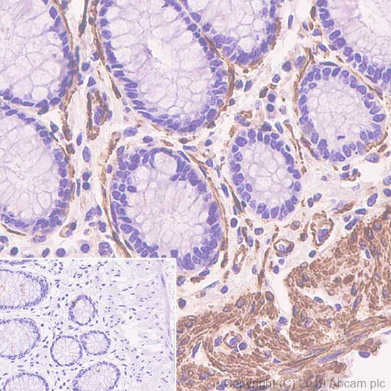 Immunohistochemistry (Formalin/PFA-fixed paraffin-embedded sections) - Anti-alpha smooth muscle Actin antibody [SP171] - BSA and Azide free (ab242395), expandable thumbnail
