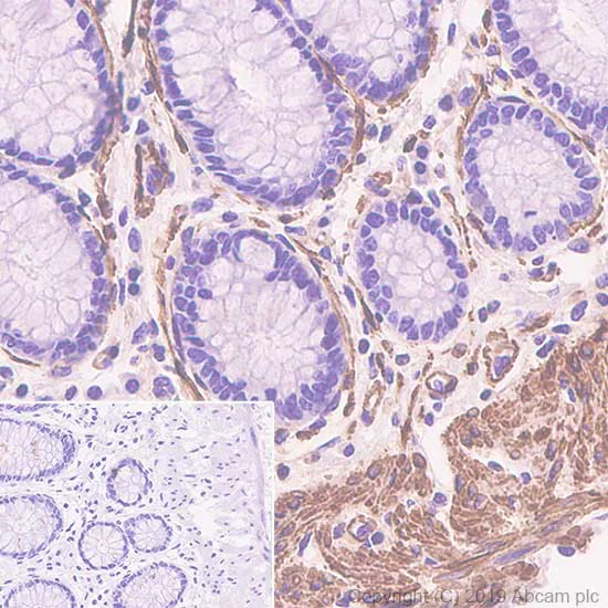 Immunohistochemistry (Formalin/PFA-fixed paraffin-embedded sections) - Anti-alpha smooth muscle Actin antibody [SP171] - BSA and Azide free (AB242395)