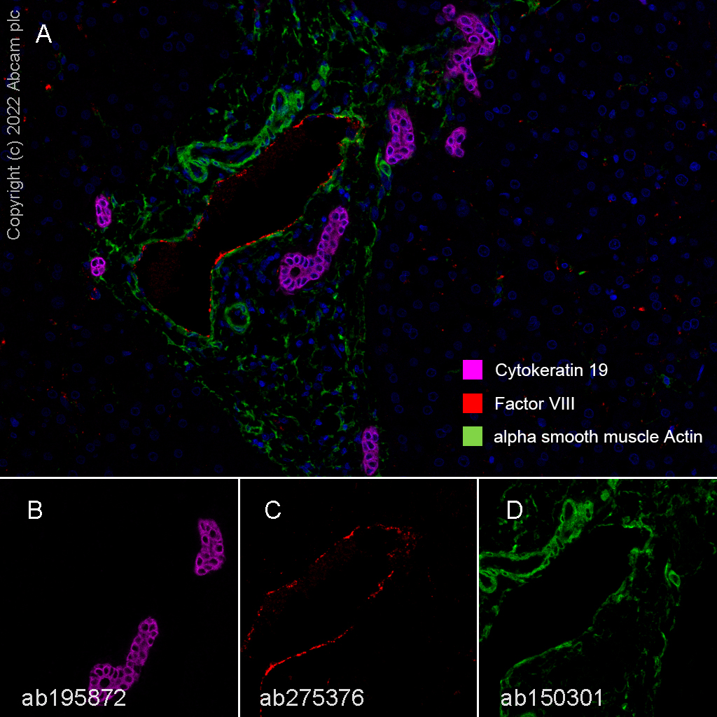 Multiplex immunohistochemistry - Anti-alpha smooth muscle Actin antibody [SP171] - BSA and Azide free (ab242395), expandable thumbnail