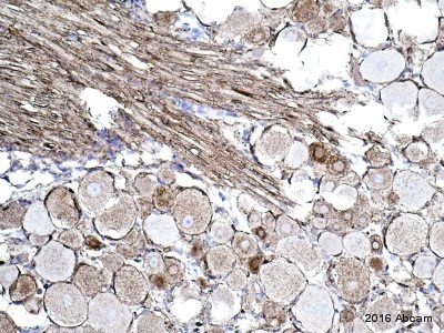 Anti-Alpha-synuclein aggregate antibody [MJFR-14-6-4-2