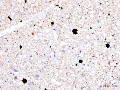 Anti-Alpha-synuclein aggregate antibody [MJFR-14-6-4-2