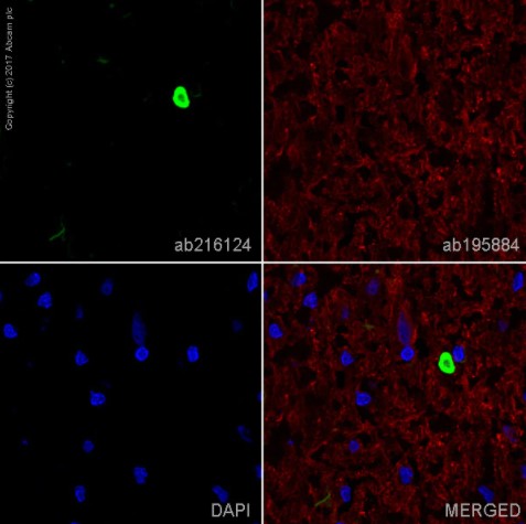 Immunocytochemistry/ Immunofluorescence - Anti-Alpha-synuclein aggregate antibody [MJFR-14-6-4-2] - Conformation-Specific (AB209538), expandable thumbnail