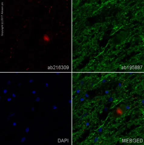 アブ1700 Anti-alpha-synuclein aggregate antibody [MJFR-14-6-4-2