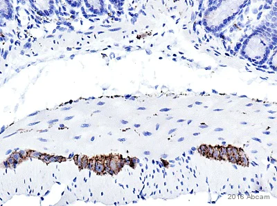 Immunohistochemistry (Formalin/PFA-fixed paraffin-embedded sections) - Anti-Alpha-synuclein aggregate antibody [MJFR-14-6-4-2] - Conformation-Specific (AB209538)