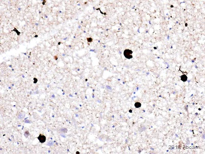 Immunohistochemistry (Formalin/PFA-fixed paraffin-embedded sections) - Anti-Alpha-synuclein aggregate antibody [MJFR-14-6-4-2] - Conformation-Specific (AB209538)