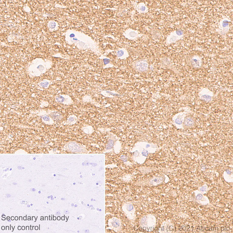 Immunohistochemistry (Formalin/PFA-fixed paraffin-embedded sections) - Anti-Alpha-synuclein antibody [42/a-Synuclein] - BSA and Azide free (AB280382)