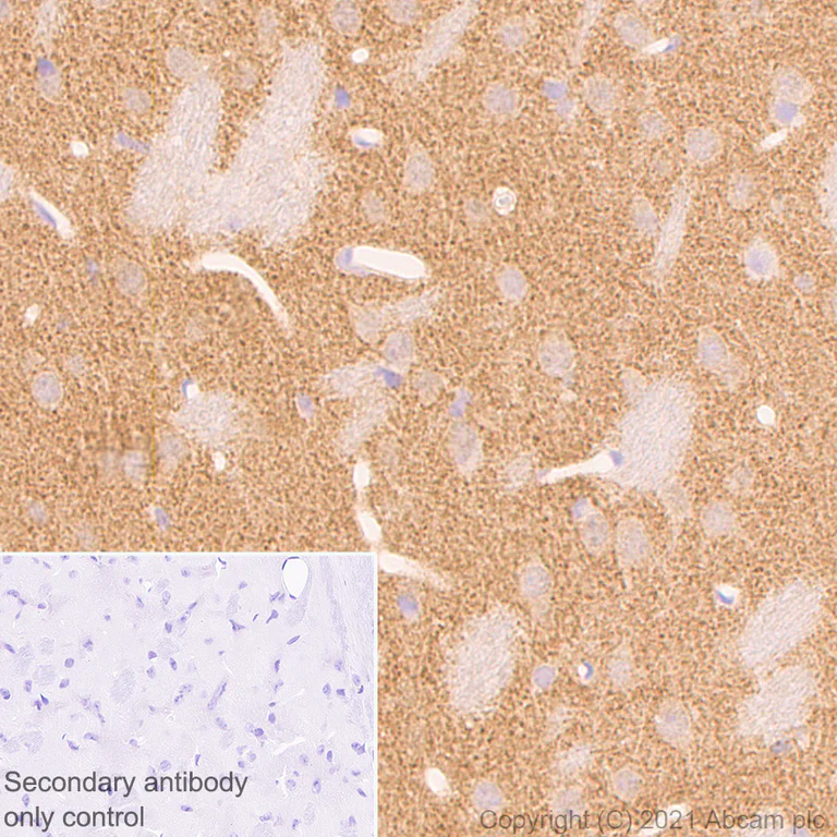 Immunohistochemistry (Formalin/PFA-fixed paraffin-embedded sections) - Anti-Alpha-synuclein antibody [42/a-Synuclein] - BSA and Azide free (AB280382)