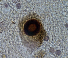 Immunohistochemistry (Formalin/PFA-fixed paraffin-embedded sections) - Anti-Alpha-synuclein antibody [4D6] - BSA and Azide free (AB1903), expandable thumbnail