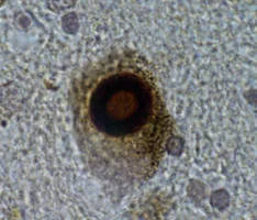 Immunohistochemistry (Formalin/PFA-fixed paraffin-embedded sections) - Anti-Alpha-synuclein antibody [4D6] - BSA and Azide free (AB1903)