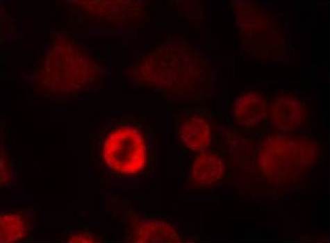 Immunocytochemistry/ Immunofluorescence - Anti-Alpha-synuclein antibody (AB131508)