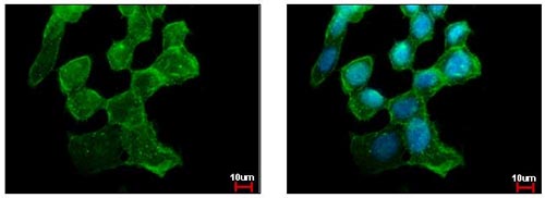 Immunocytochemistry/ Immunofluorescence - Anti-Alpha-synuclein antibody (AB155038), expandable thumbnail