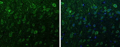 Immunohistochemistry (Formalin/PFA-fixed paraffin-embedded sections) - Anti-Alpha-synuclein antibody (AB155038)