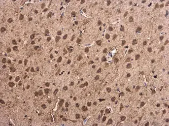 Immunohistochemistry (Formalin/PFA-fixed paraffin-embedded sections) - Anti-Alpha-synuclein antibody (AB155038)