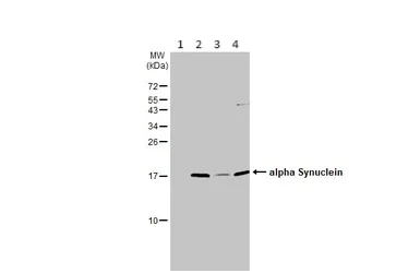 Western blot - Anti-Alpha-synuclein antibody (AB155038)